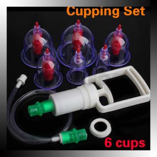 cupping, massage in Massage
