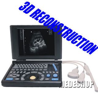   Ultrasound Scanner Machine 3.5M Convex Probe Free External 3D Software