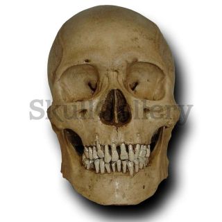 Human Skull Resin Replica Model Lifesize Museum Quality *Fast Shipping 