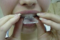 Professional Teeth Whitening Dental Kit 44% Carbamide Gel Tooth 